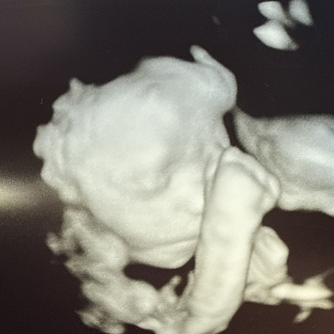 Photo shared by Diane for their Babylist baby registry.