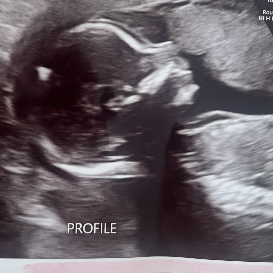 Photo shared by Emily for their Babylist baby registry.