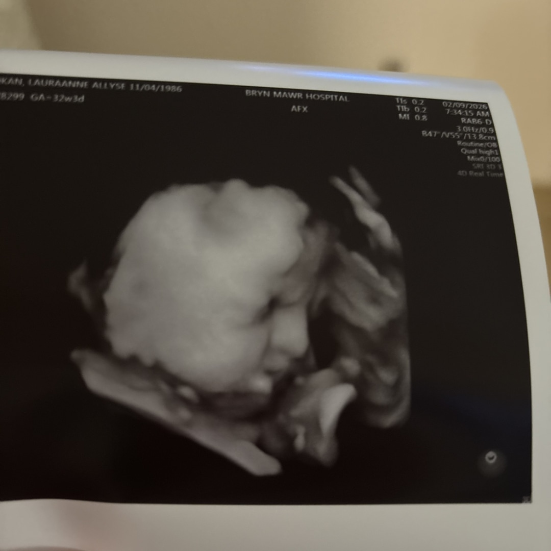 Photo shared by Lauraanne for their Babylist baby registry.