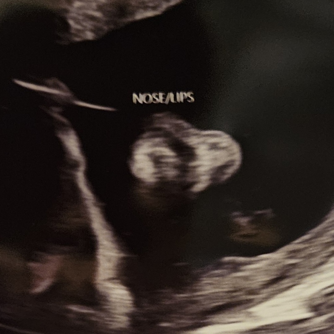 Photo shared by Carina for their Babylist baby registry.