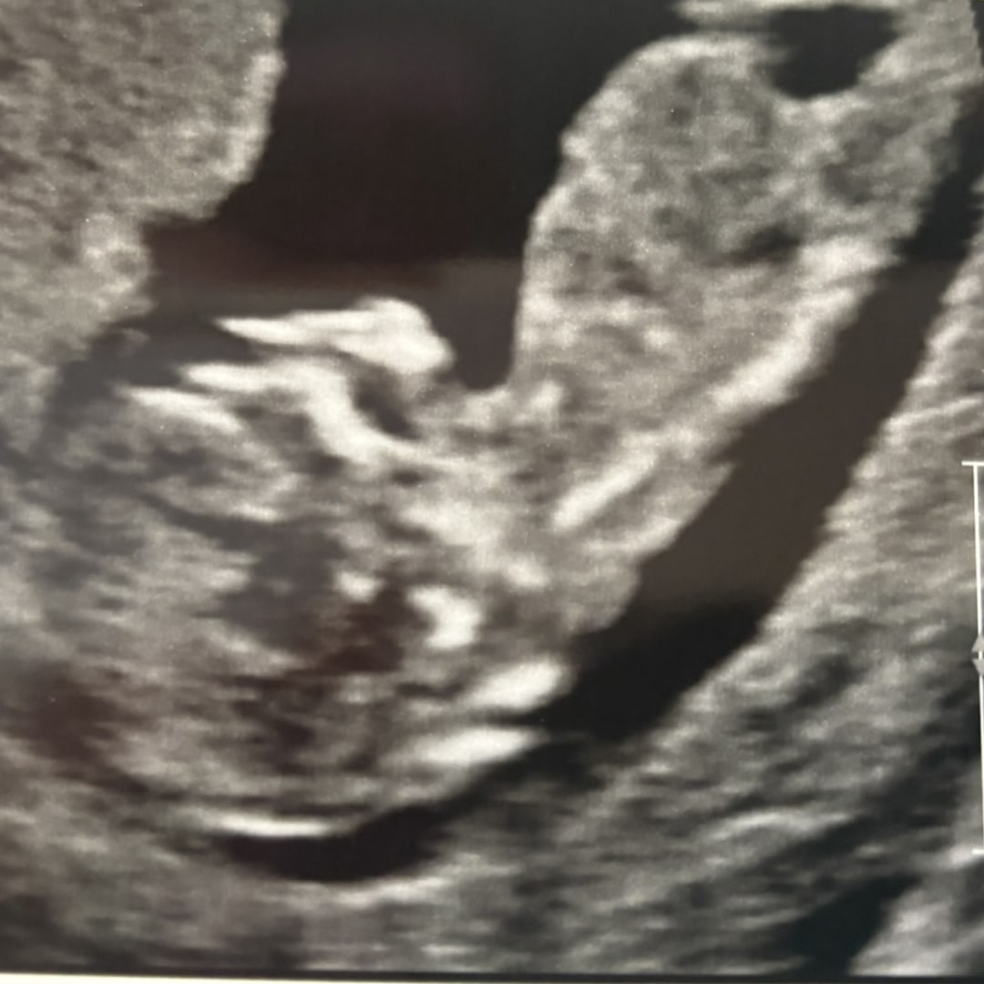 Photo shared by Liz for their Babylist baby registry.