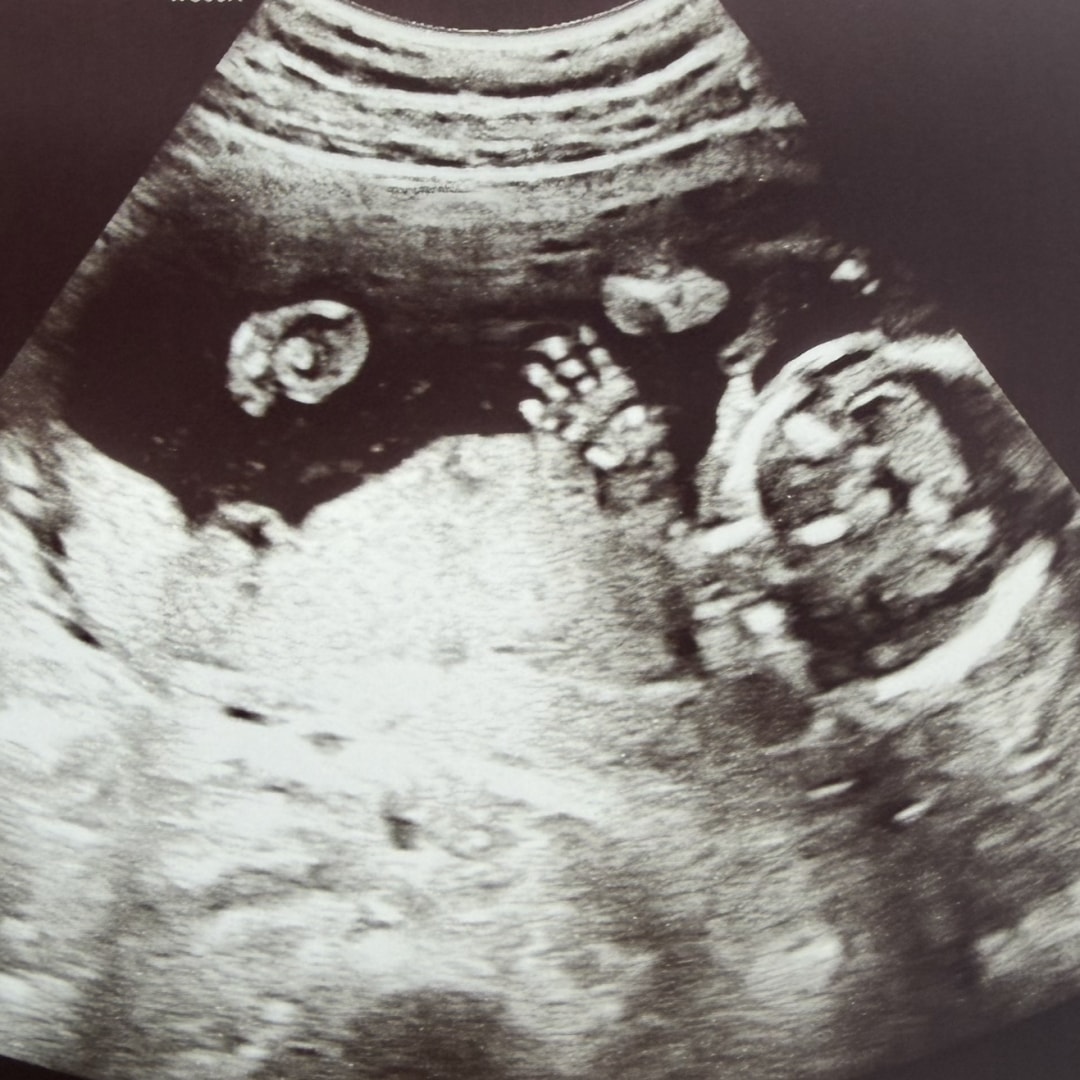 Photo shared by Shelby for their Babylist baby registry.