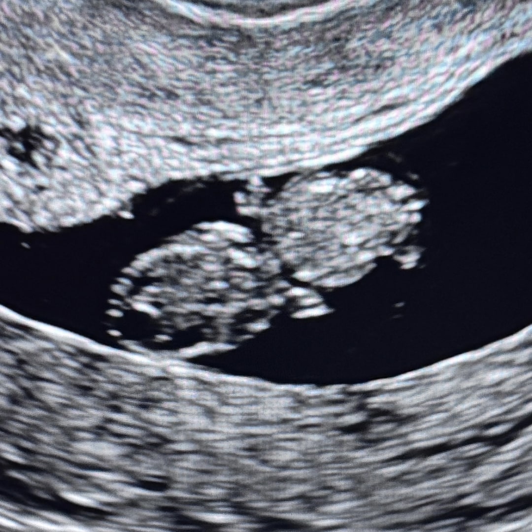 Photo shared by Stephanie for their Babylist baby registry.