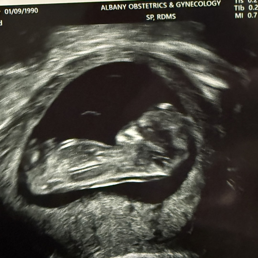 Photo shared by Molly for their Babylist baby registry.