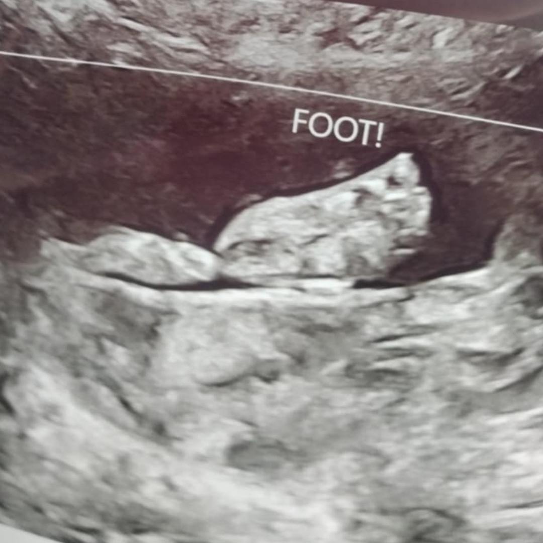 Photo shared by Alexis for their Babylist baby registry.
