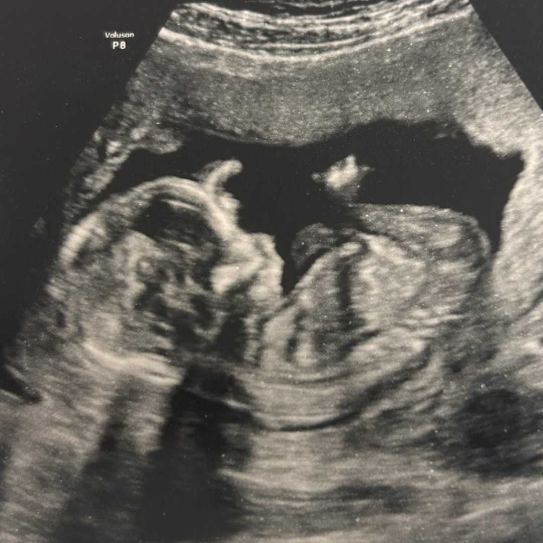 Photo shared by Evelyn for their Babylist baby registry.
