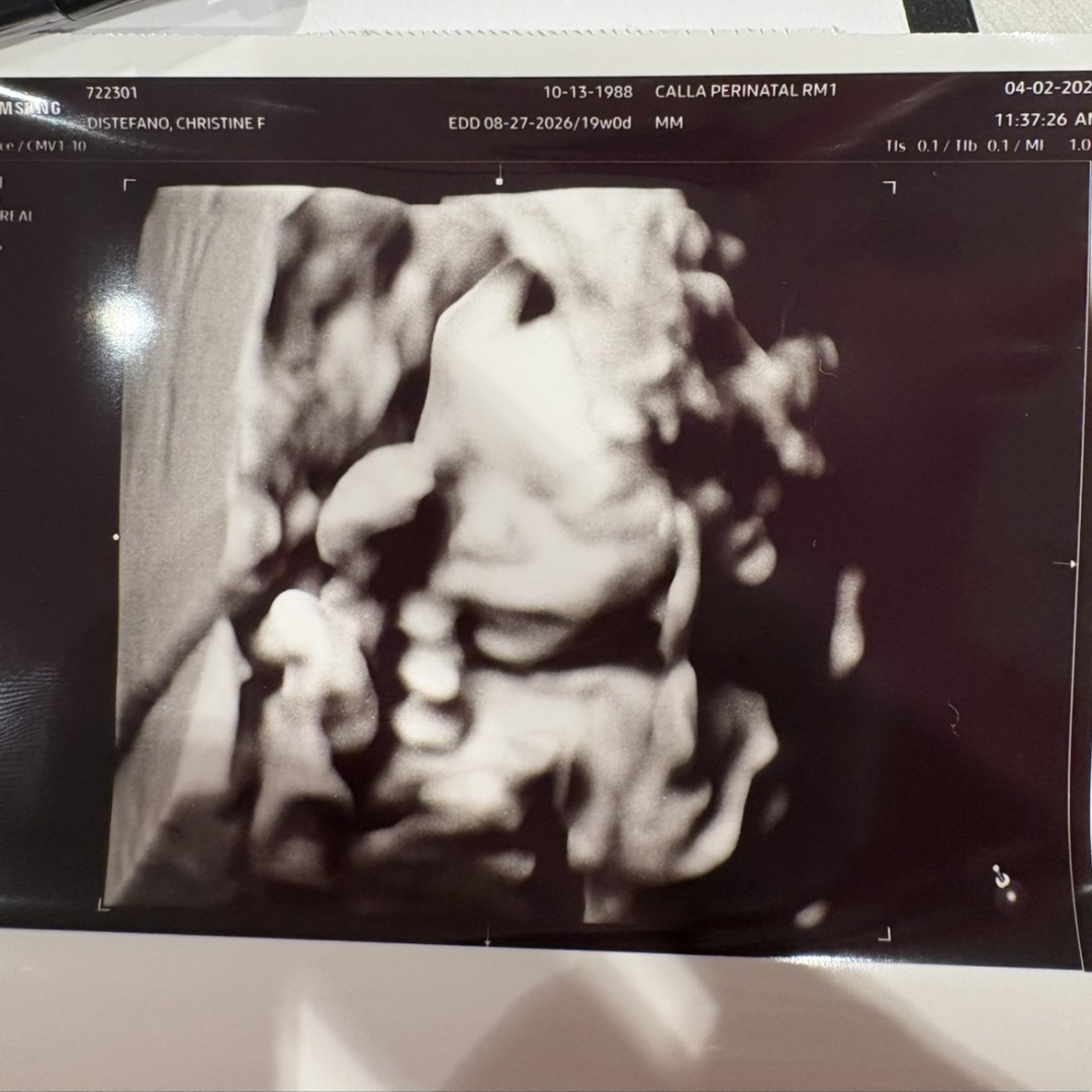 Photo shared by Christine for their Babylist baby registry.