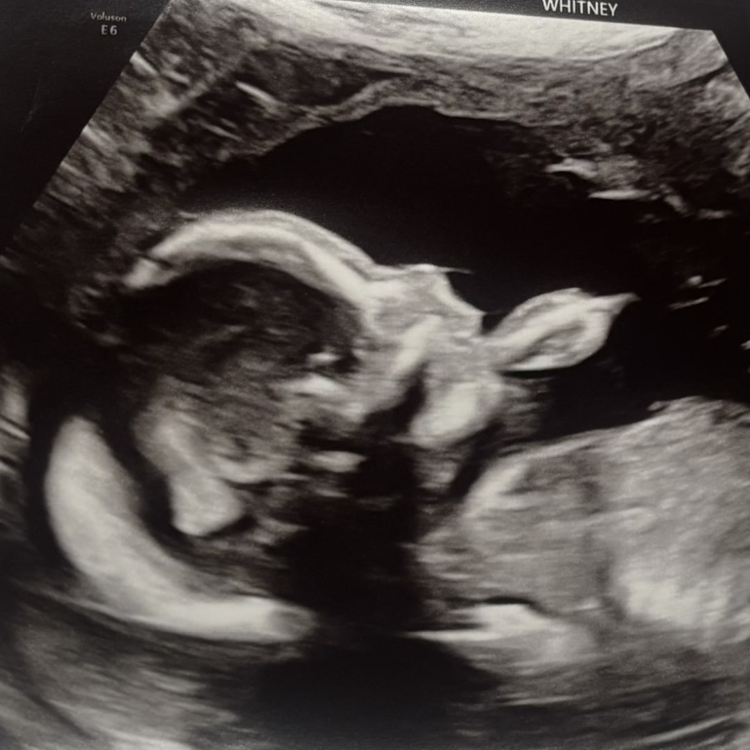Photo shared by Elizabeth for their Babylist baby registry.