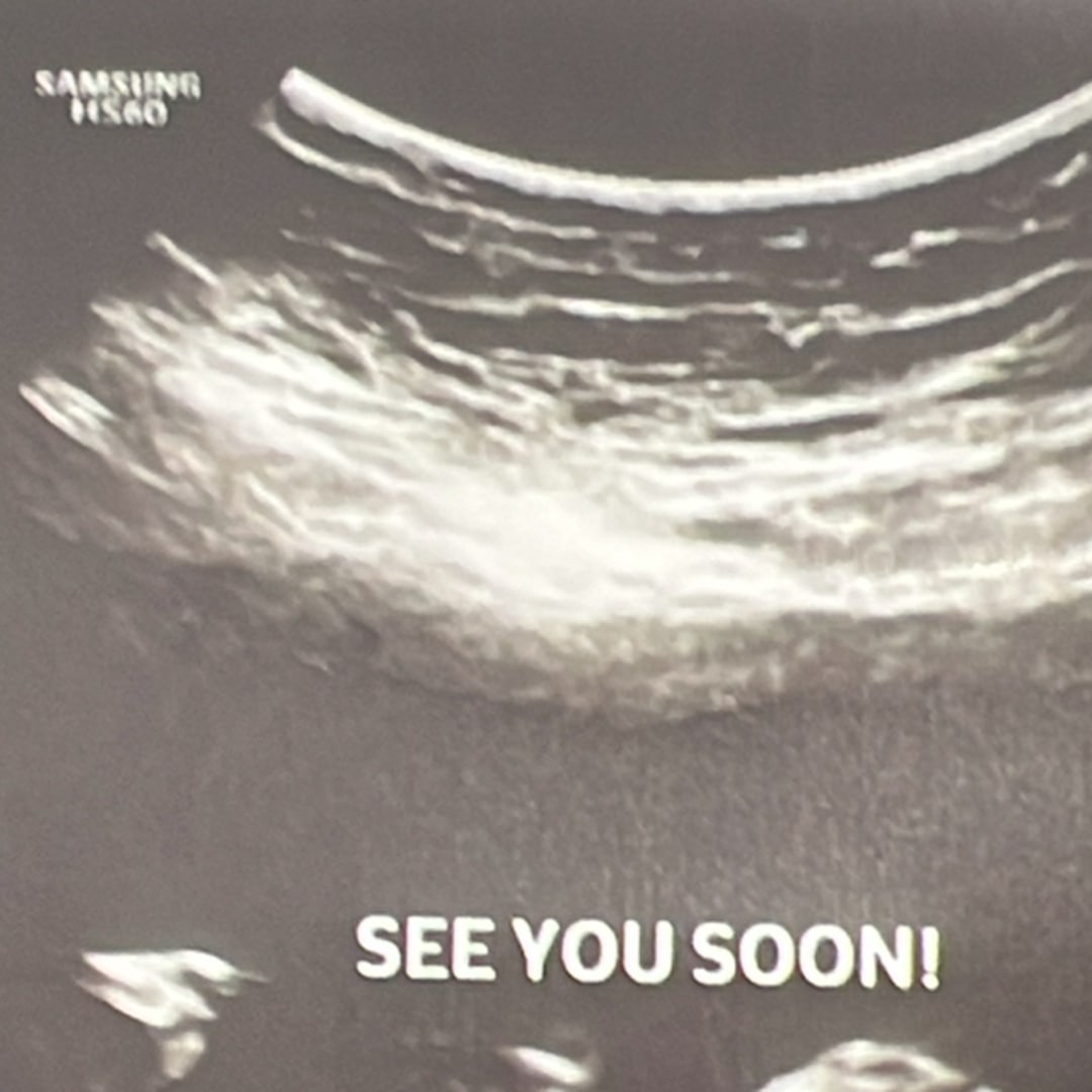 Photo shared by Jossilyn for their Babylist baby registry.