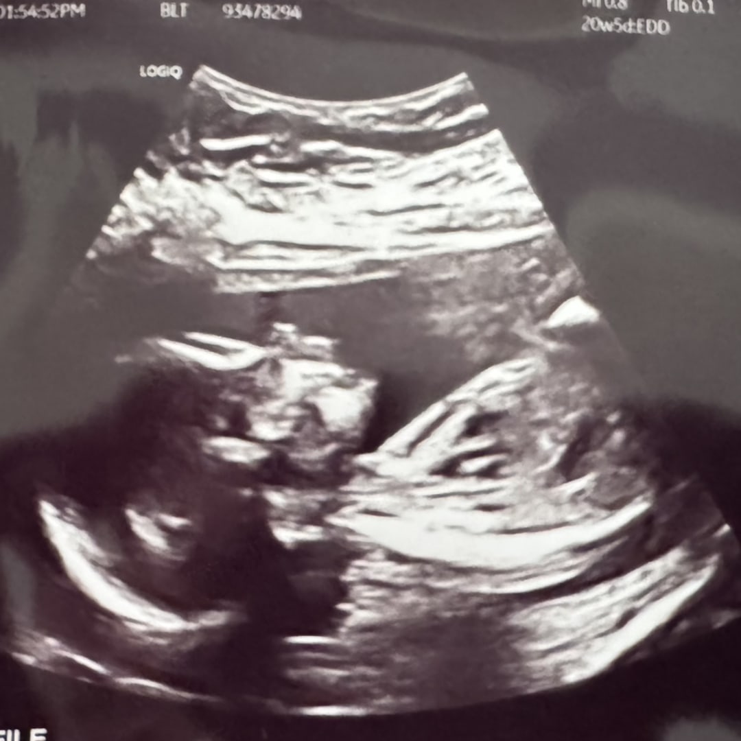 Photo shared by Daniella for their Babylist baby registry.