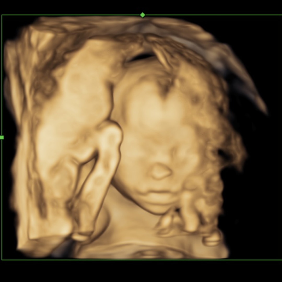 Photo shared by Carly for their Babylist baby registry.