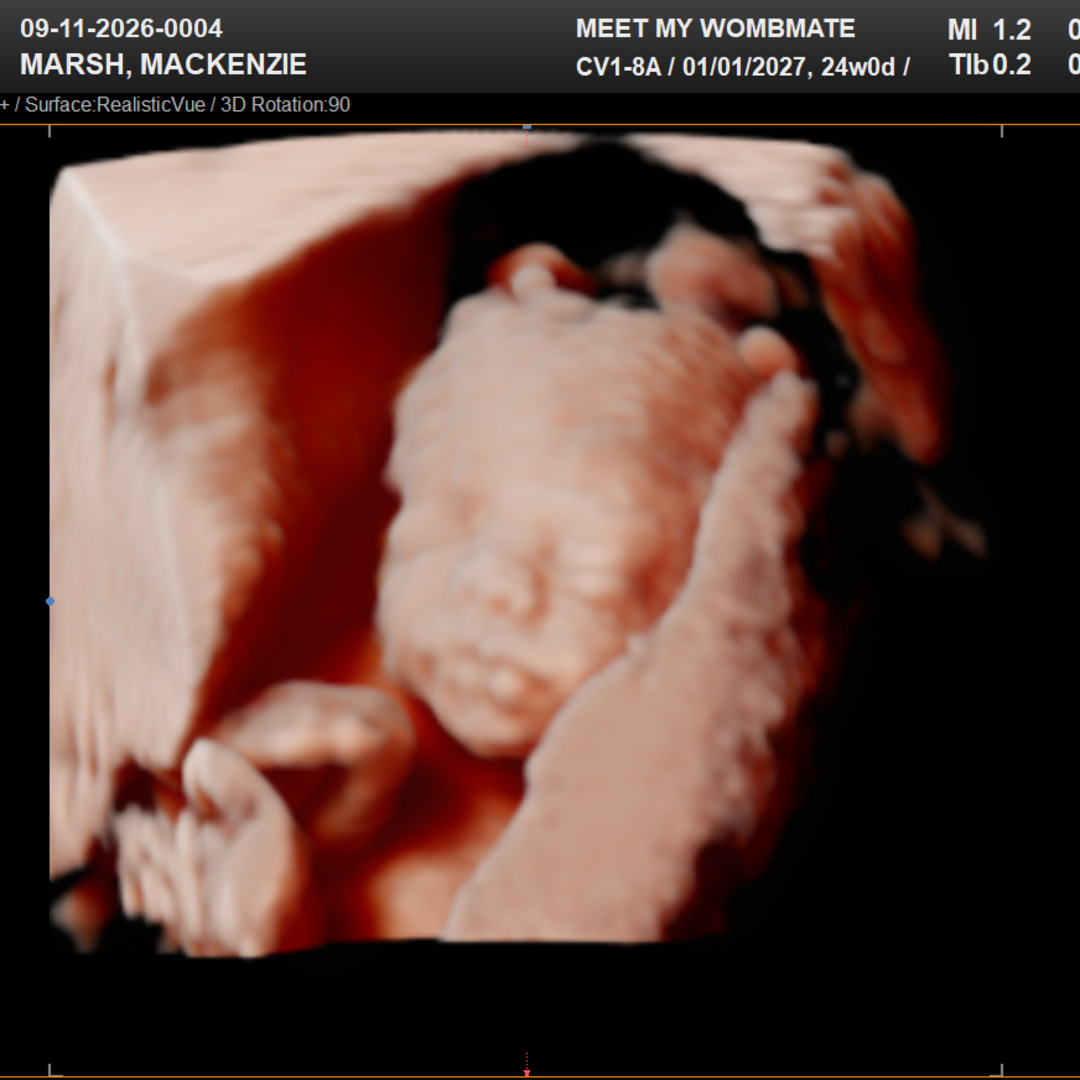 Photo shared by Mackenzie for their Babylist baby registry.