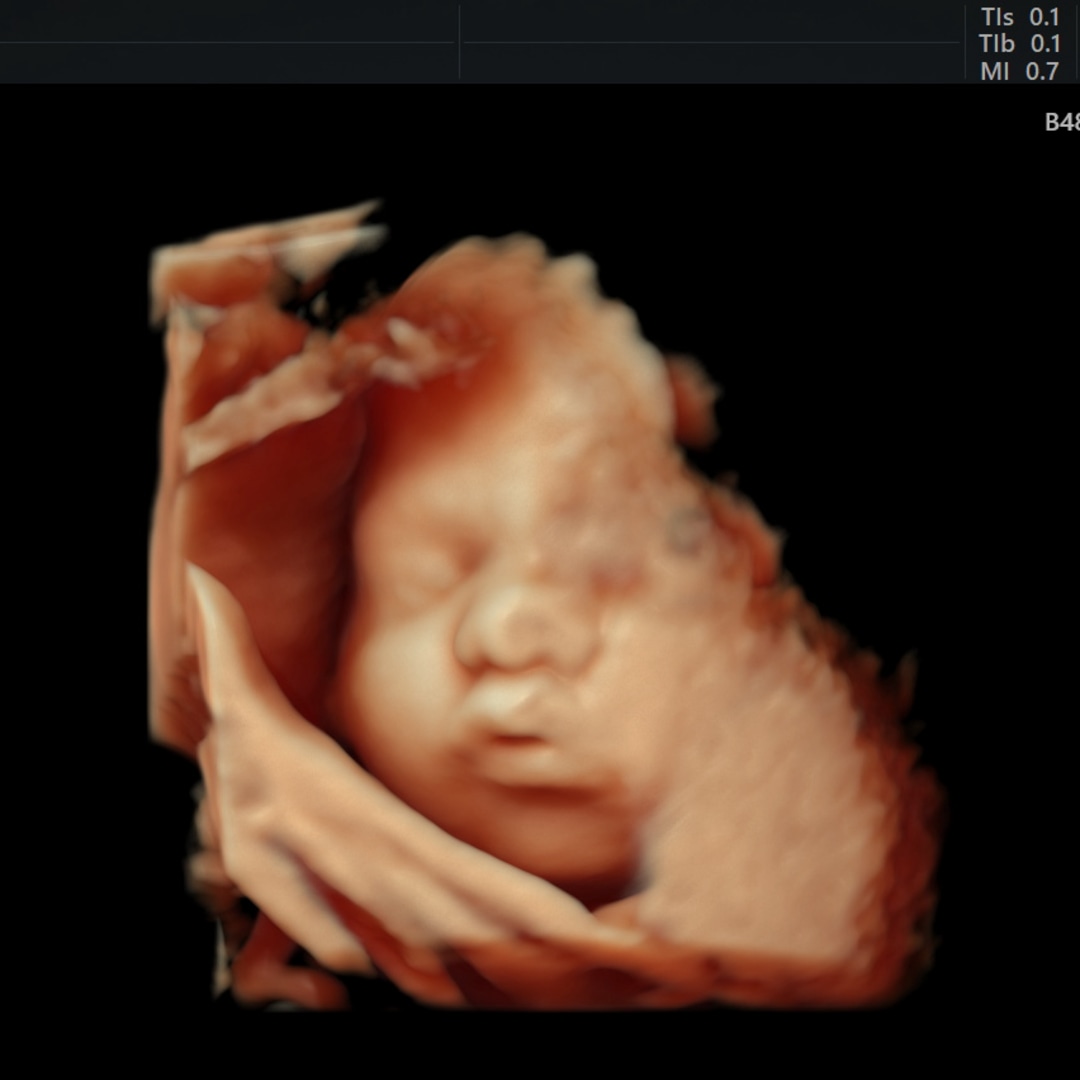 Photo shared by Destiny for their Babylist baby registry.