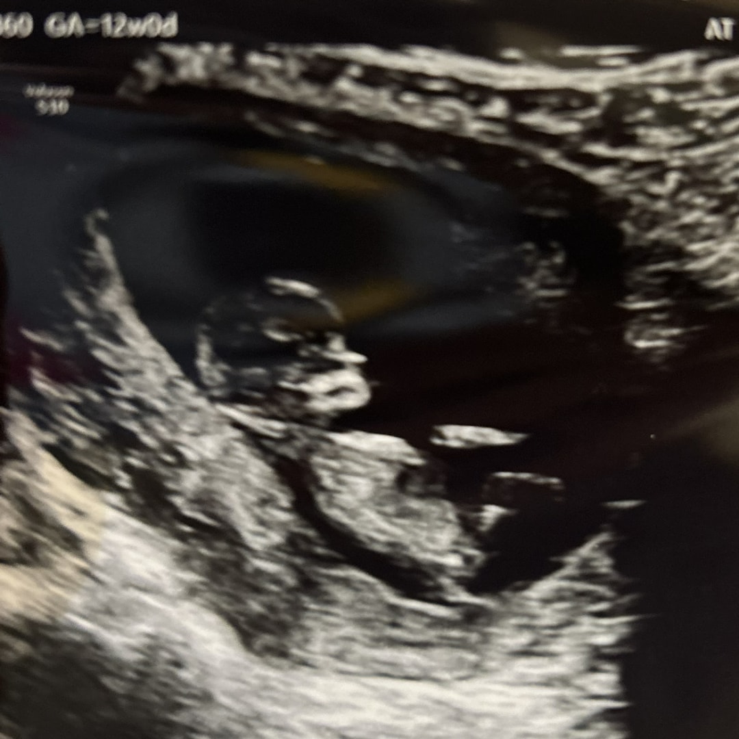 Photo shared by Angela for their Babylist baby registry.