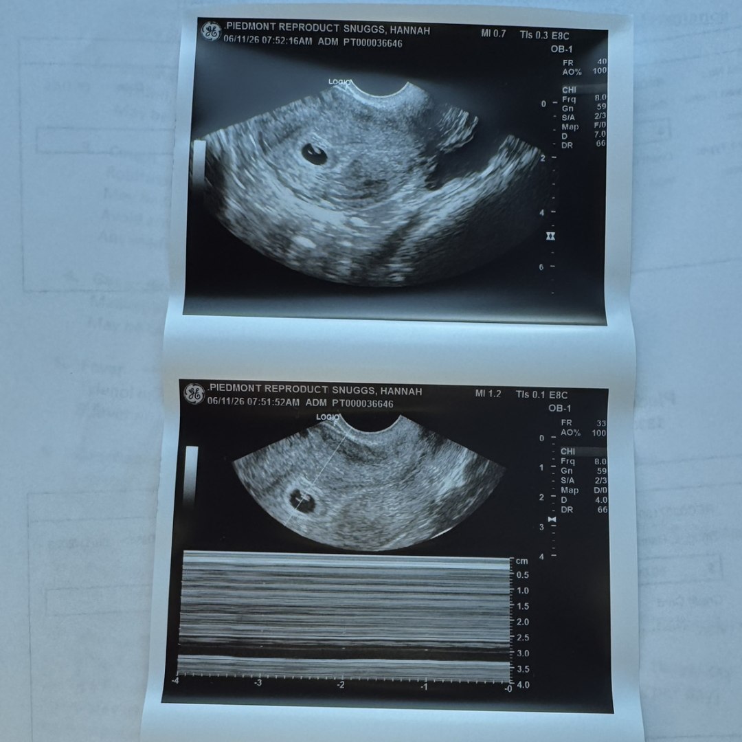 Photo shared by Hannah for their Babylist baby registry.