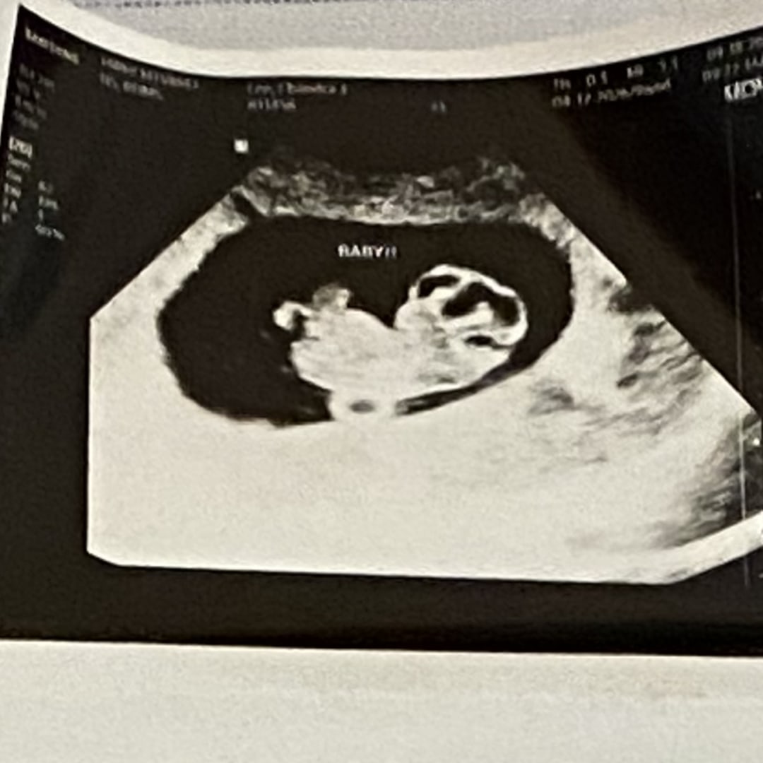 Photo shared by Chandra for their Babylist baby registry.