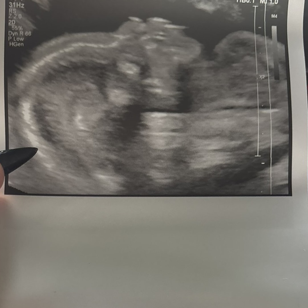Photo shared by Neela for their Babylist baby registry.