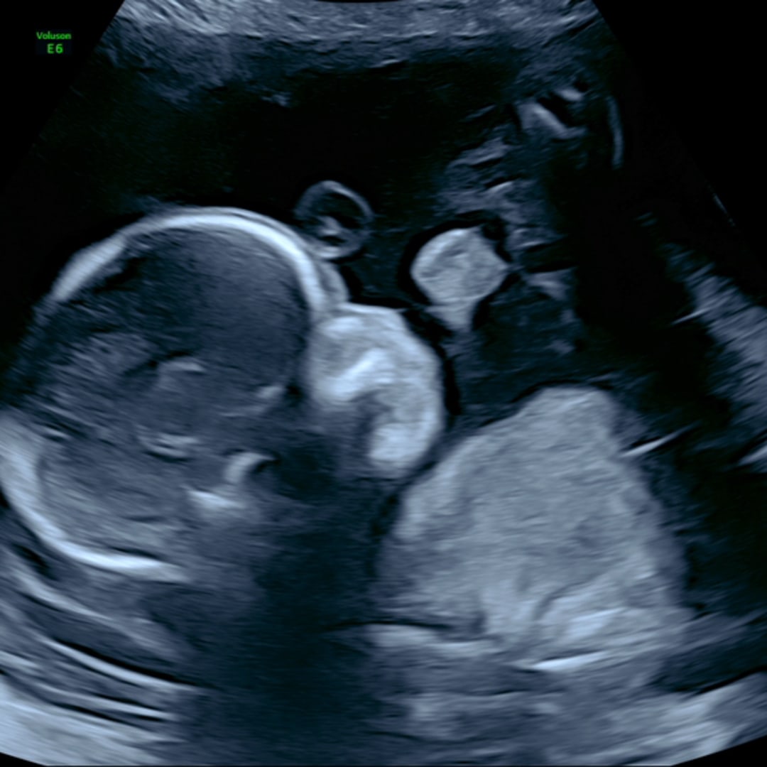 Photo shared by Bridgette for their Babylist baby registry.