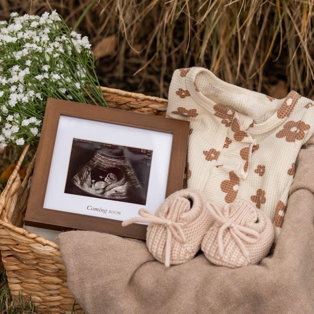 Photo shared by Skylar for their Babylist baby registry.