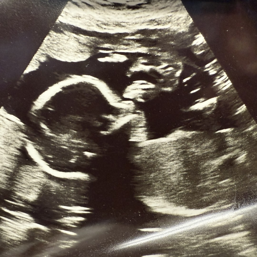 Photo shared by Adriene for their Babylist baby registry.