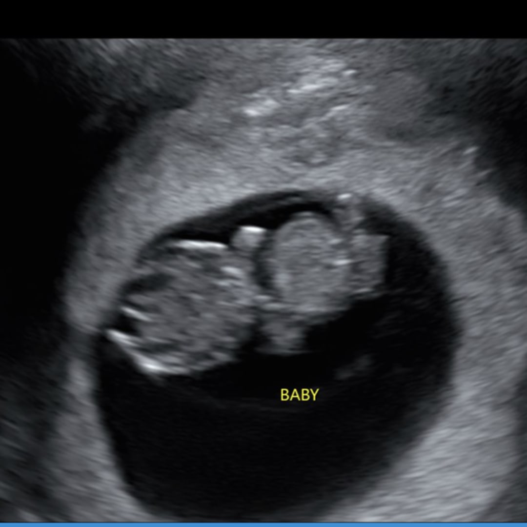 Photo shared by Jaqueline for their Babylist baby registry.
