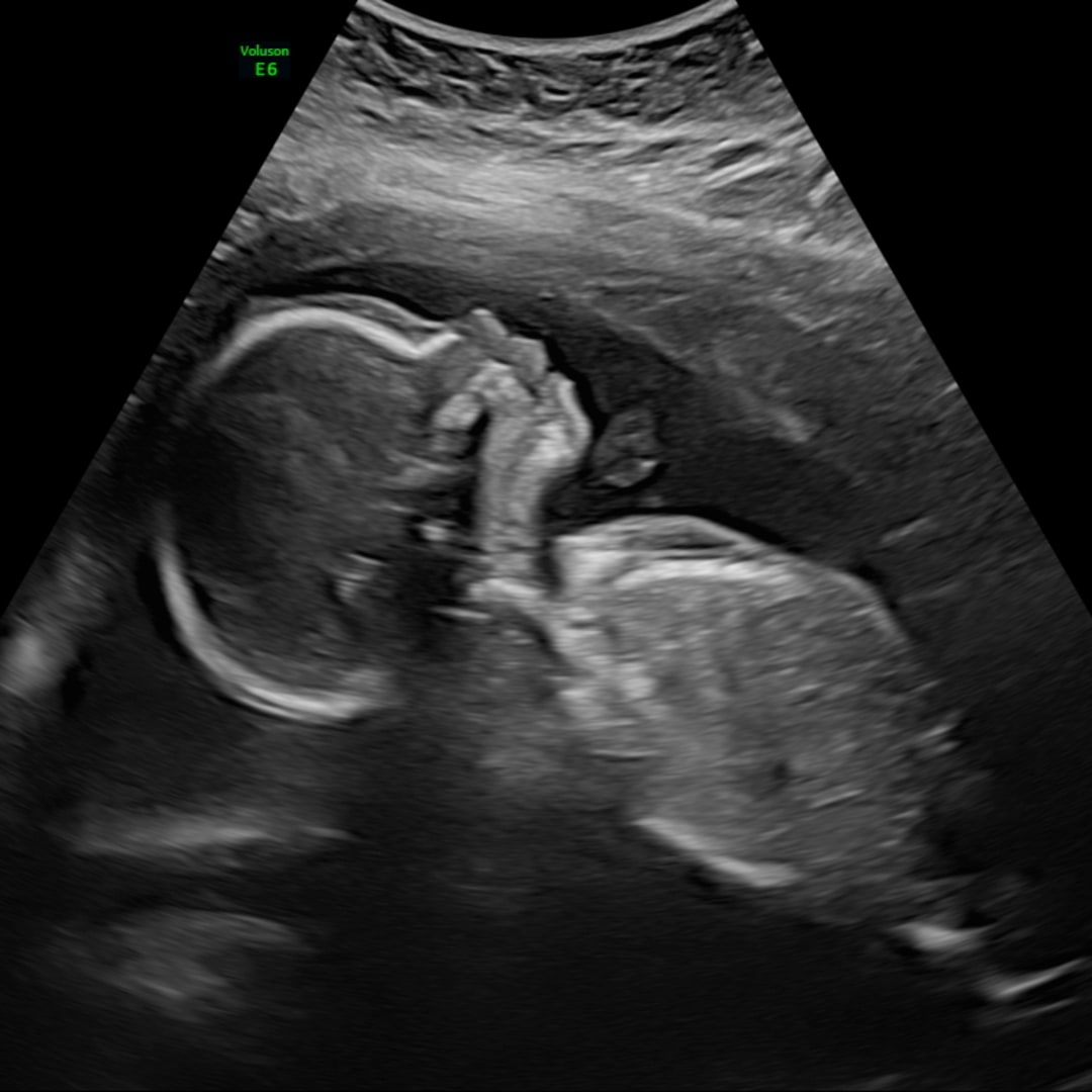 Photo shared by Michelle for their Babylist baby registry.