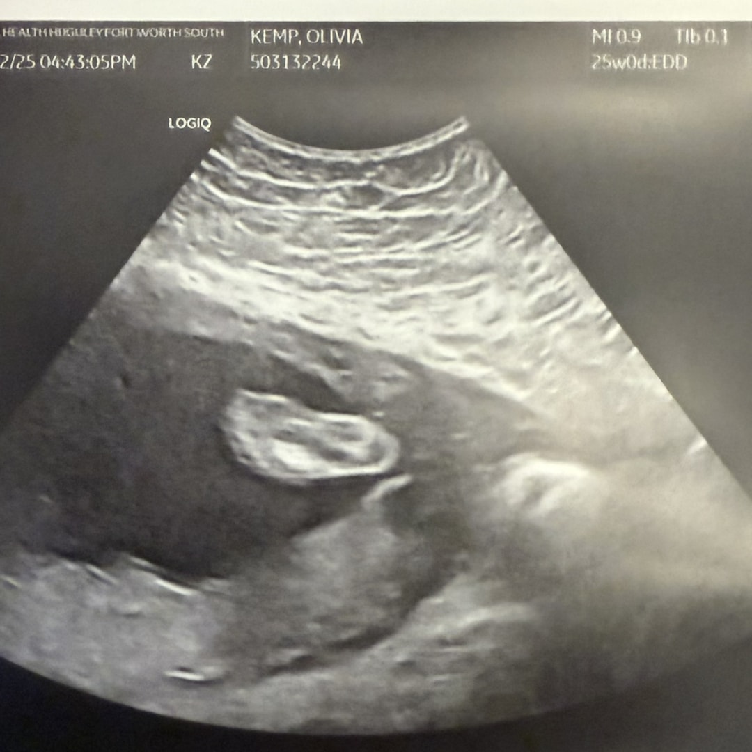 Photo shared by Olivia for their Babylist baby registry.