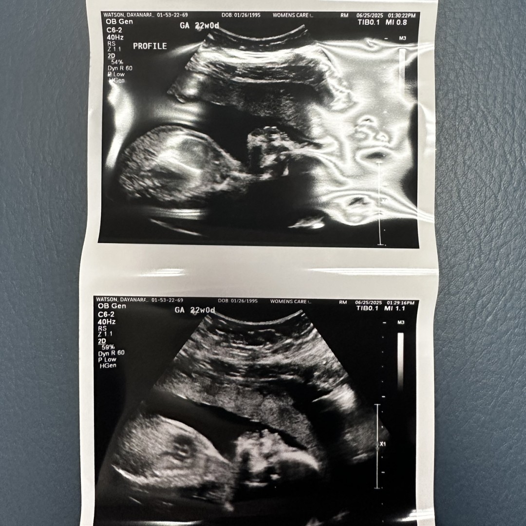 Photo shared by Dayanara for their Babylist baby registry.
