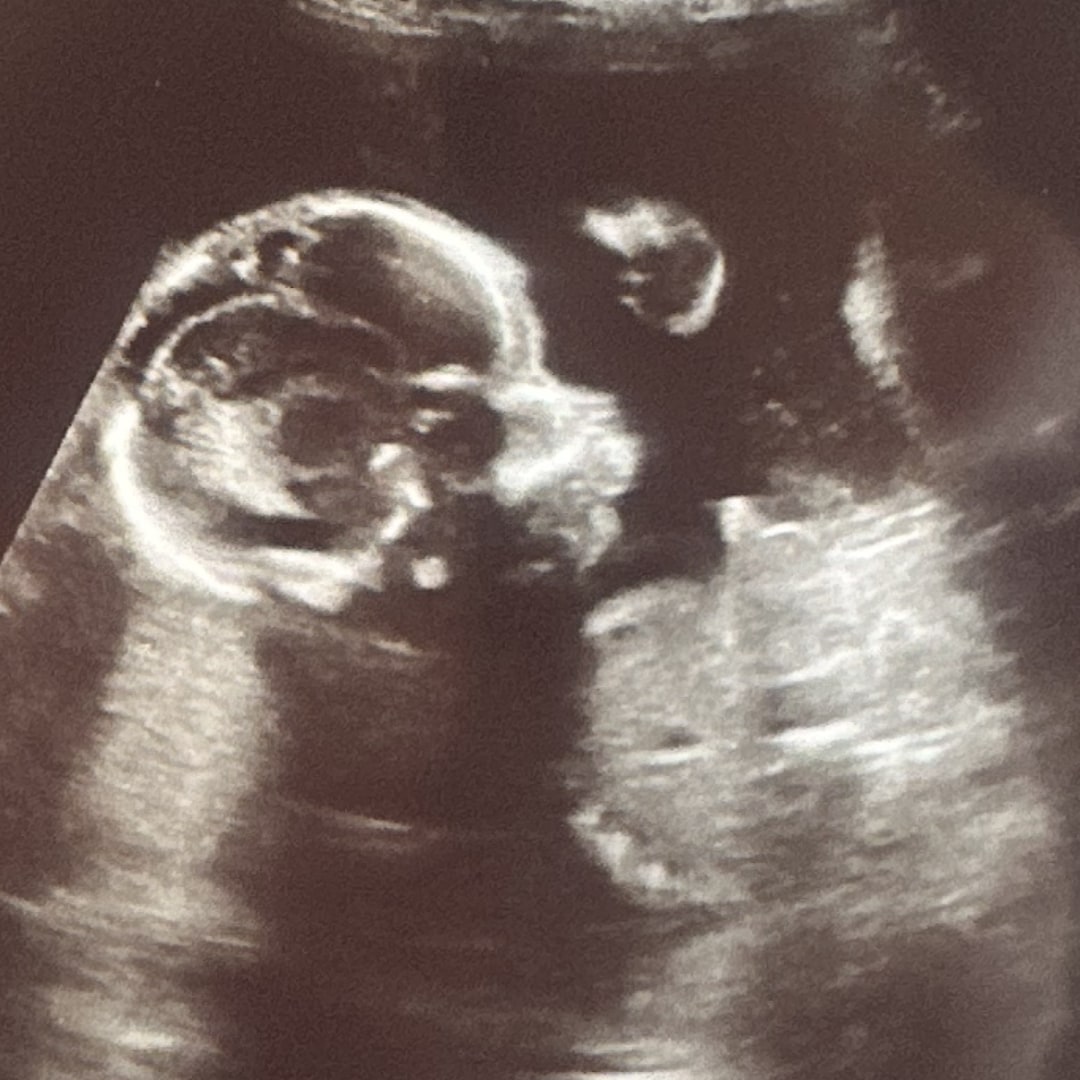 Photo shared by McKenna for their Babylist baby registry.