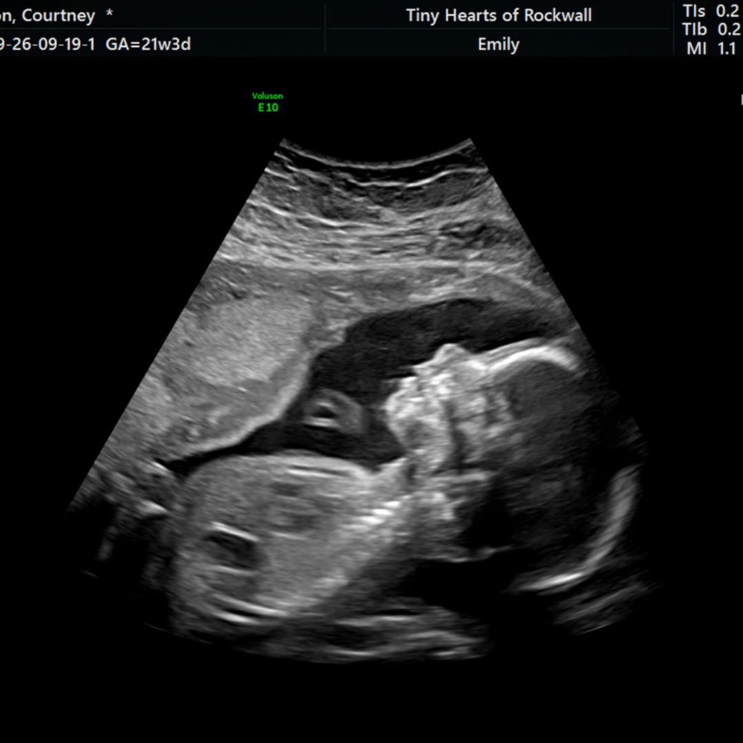 Photo shared by Courtney for their Babylist baby registry.