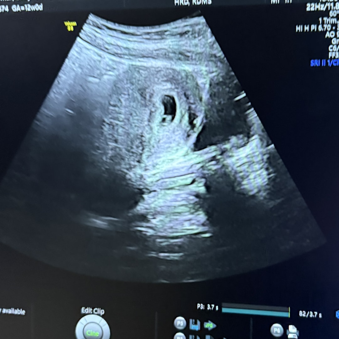 Photo shared by Emily for their Babylist baby registry.