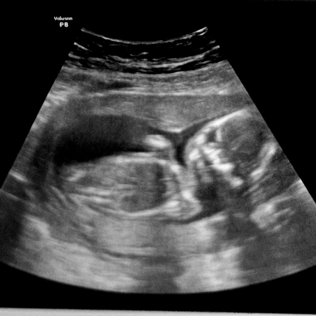 Photo shared by Theodora for their Babylist baby registry.