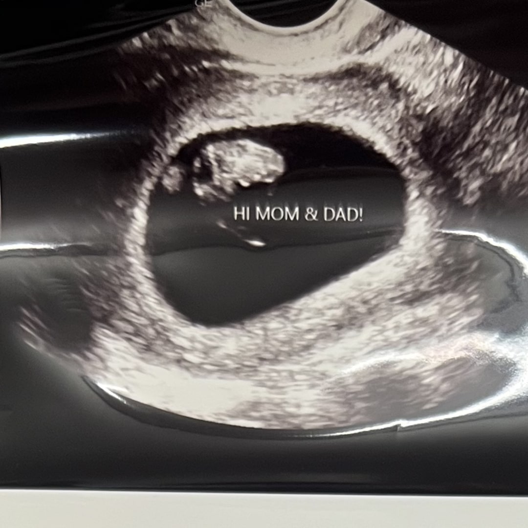 Photo shared by Sydney for their Babylist baby registry.