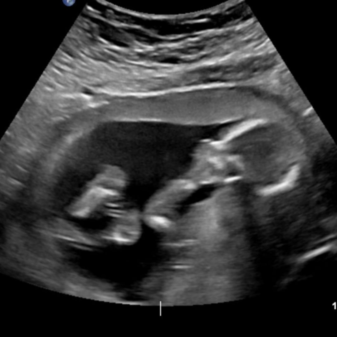 Photo shared by Ashlyn for their Babylist baby registry.