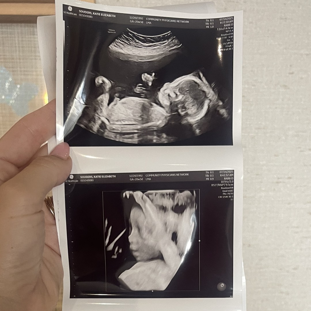 Photo shared by Katie for their Babylist baby registry.