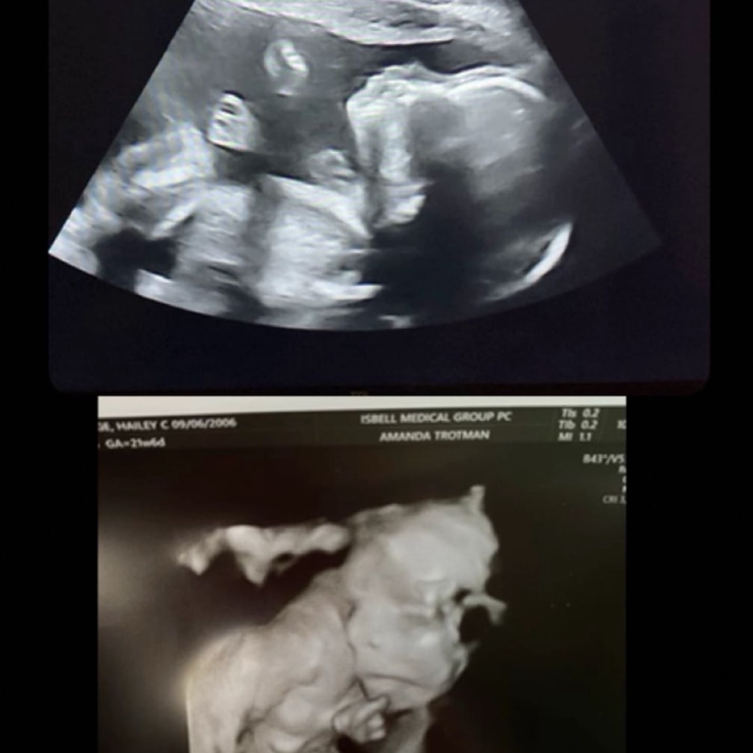 Photo shared by Hailey for their Babylist baby registry.