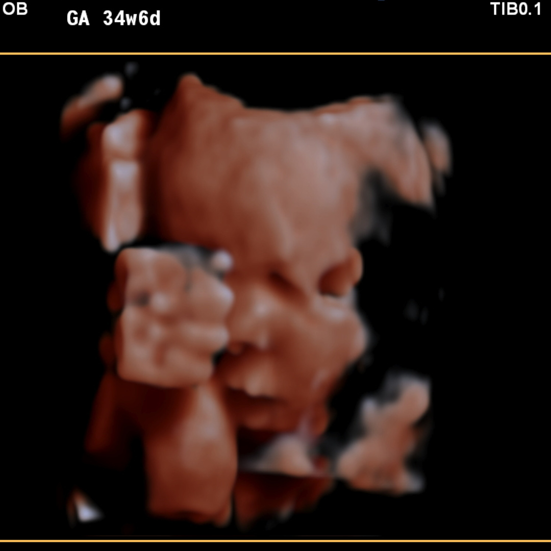 Photo shared by Jeneda for their Babylist baby registry.