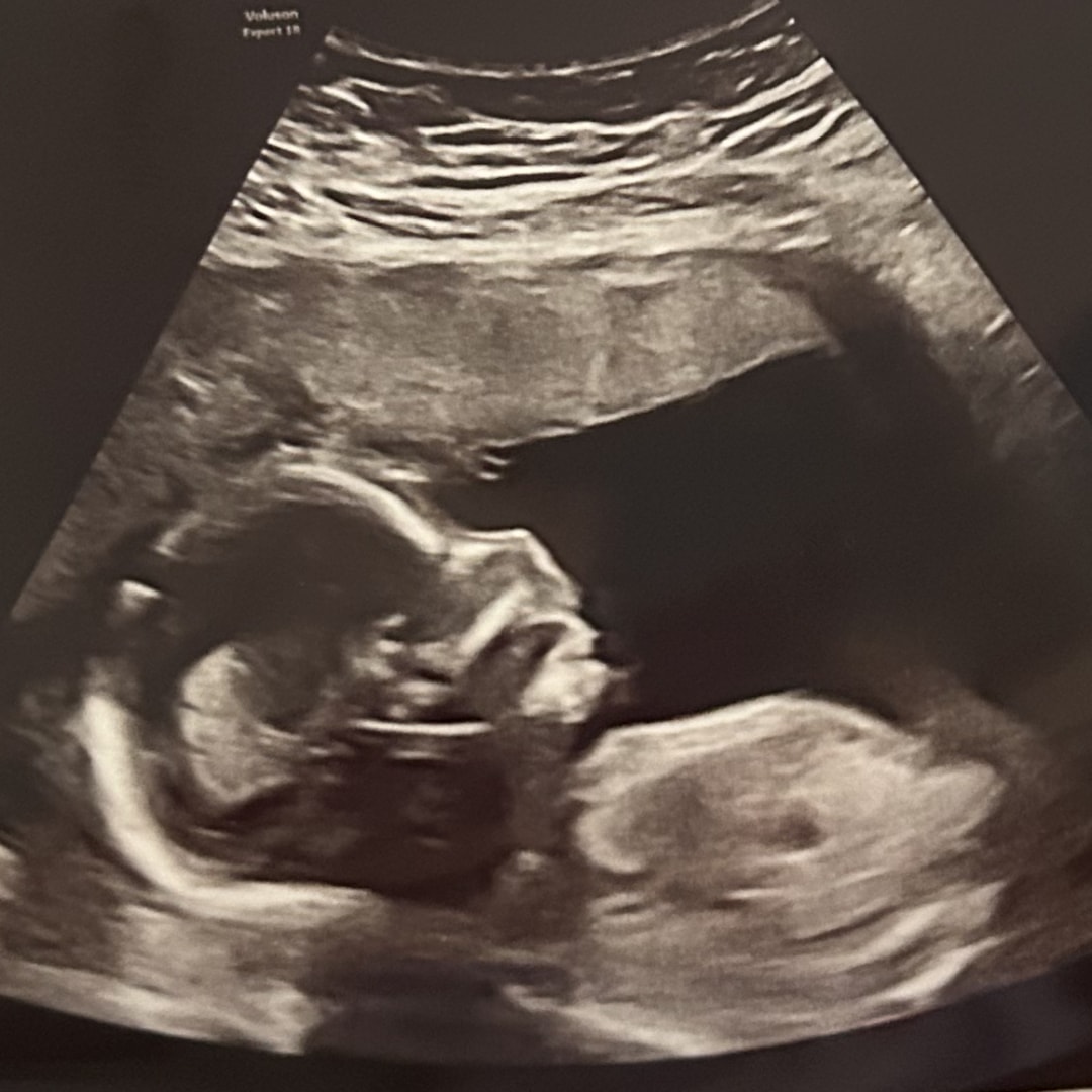 Photo shared by Allie for their Babylist baby registry.