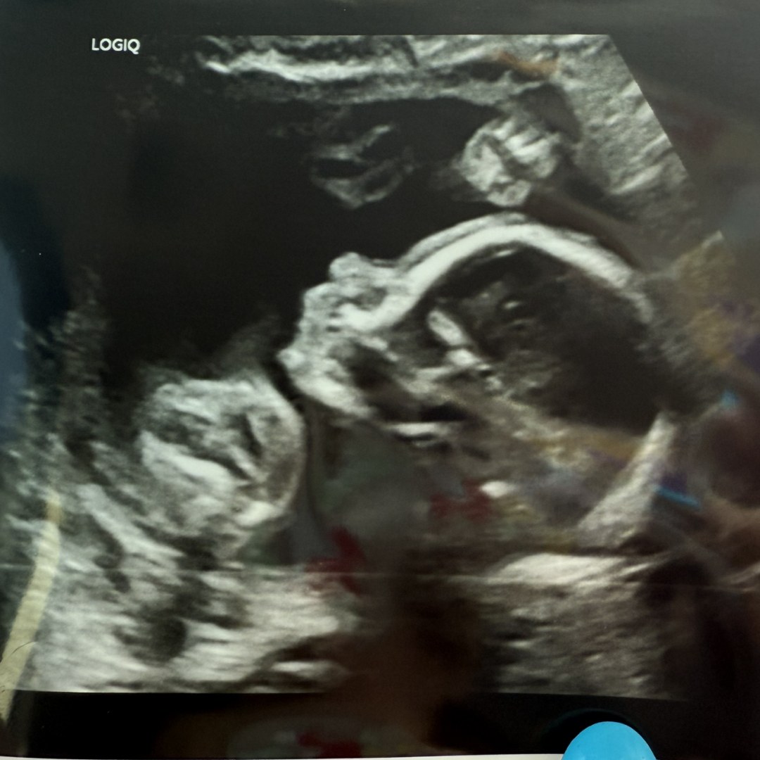 Photo shared by Samantha for their Babylist baby registry.