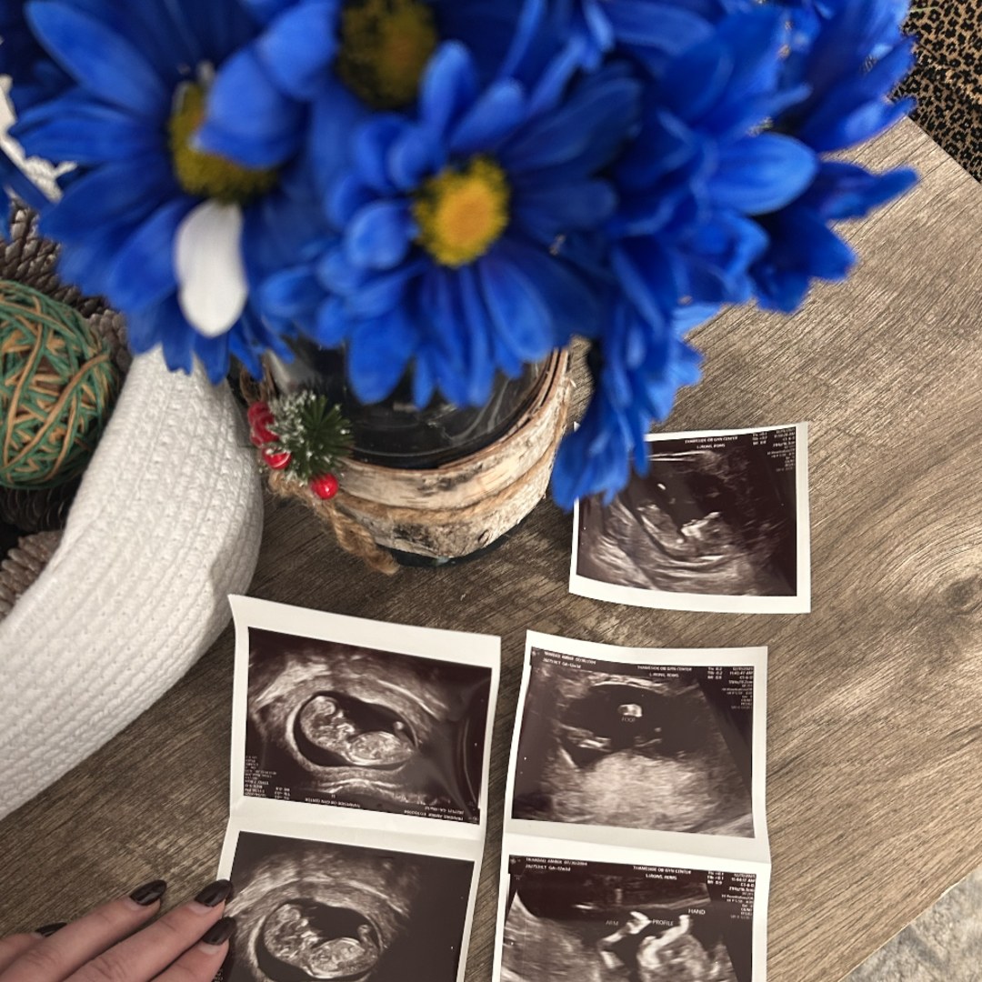 Photo shared by Amber for their Babylist baby registry.