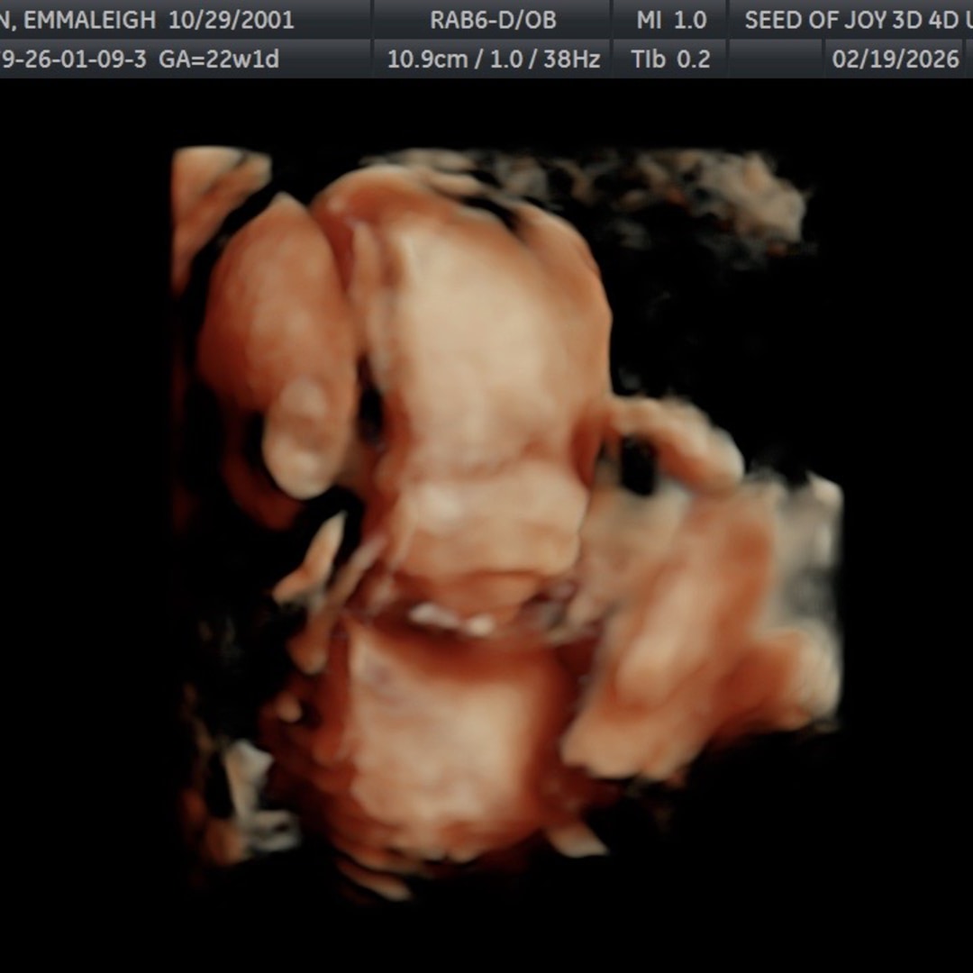 Photo shared by Gavin for their Babylist baby registry.