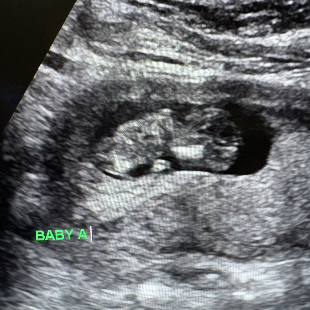 Photo shared by Alyssa for their Babylist baby registry.