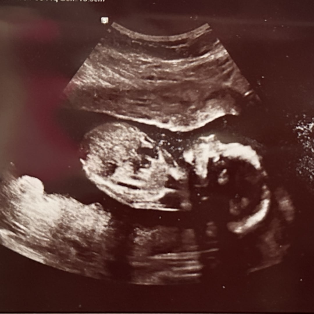 Photo shared by Desiree for their Babylist baby registry.