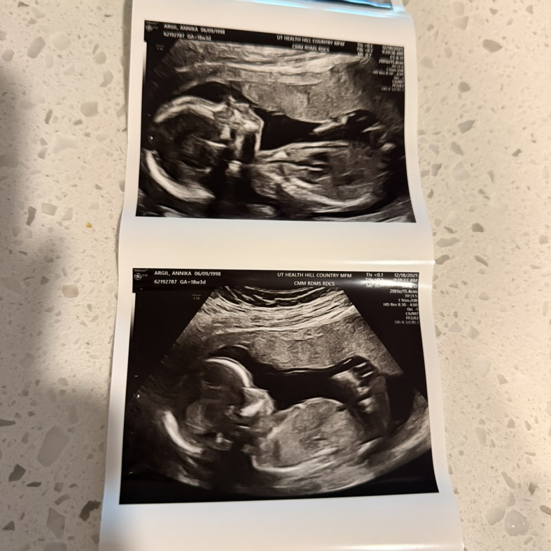 Photo shared by Annika for their Babylist baby registry.