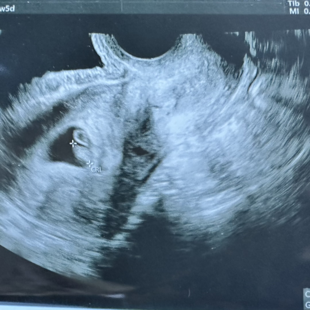 Photo shared by Josseline for their Babylist baby registry.