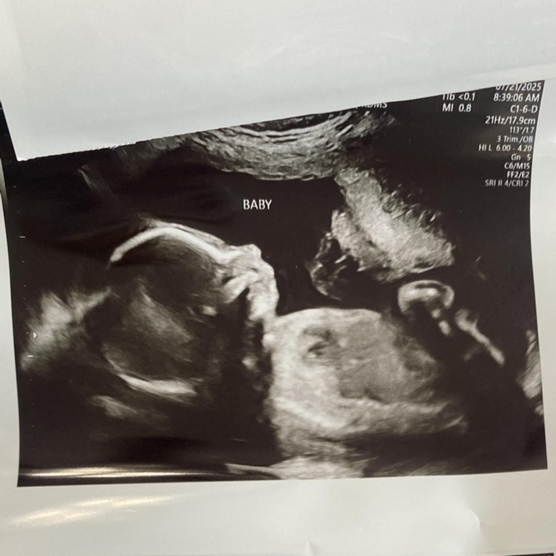 Photo shared by Brandi for their Babylist baby registry.