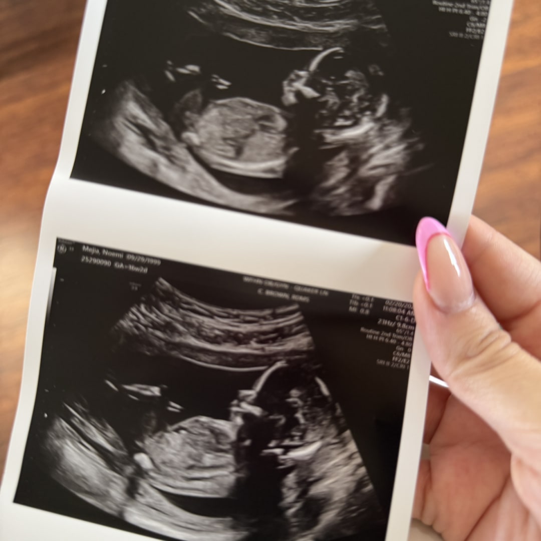 Photo shared by Noemi for their Babylist baby registry.