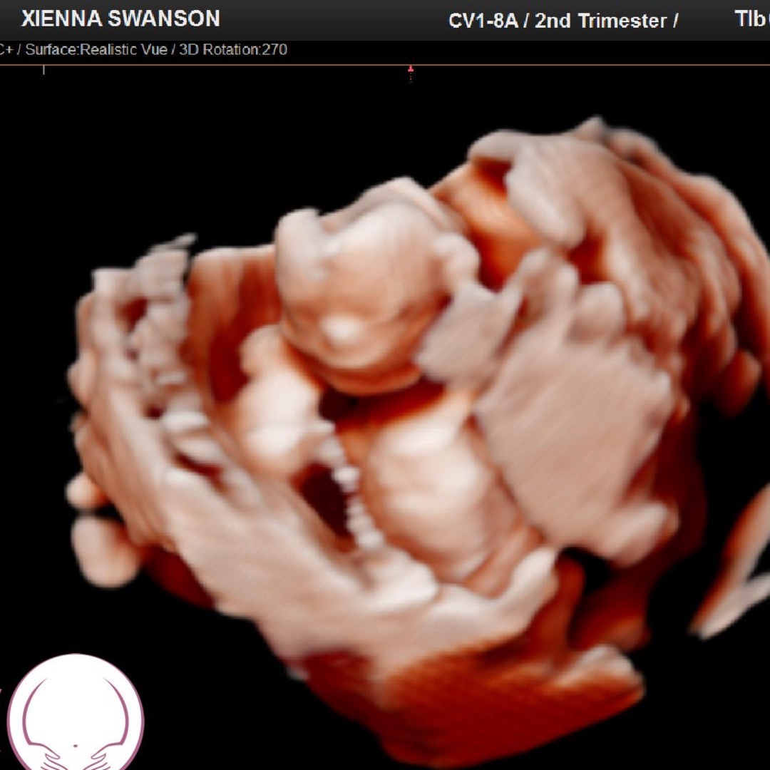 Photo shared by Xienna for their Babylist baby registry.