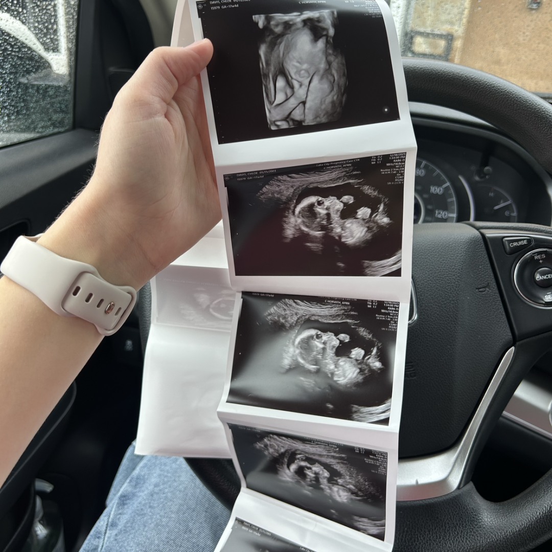 Photo shared by Chloe for their Babylist baby registry.