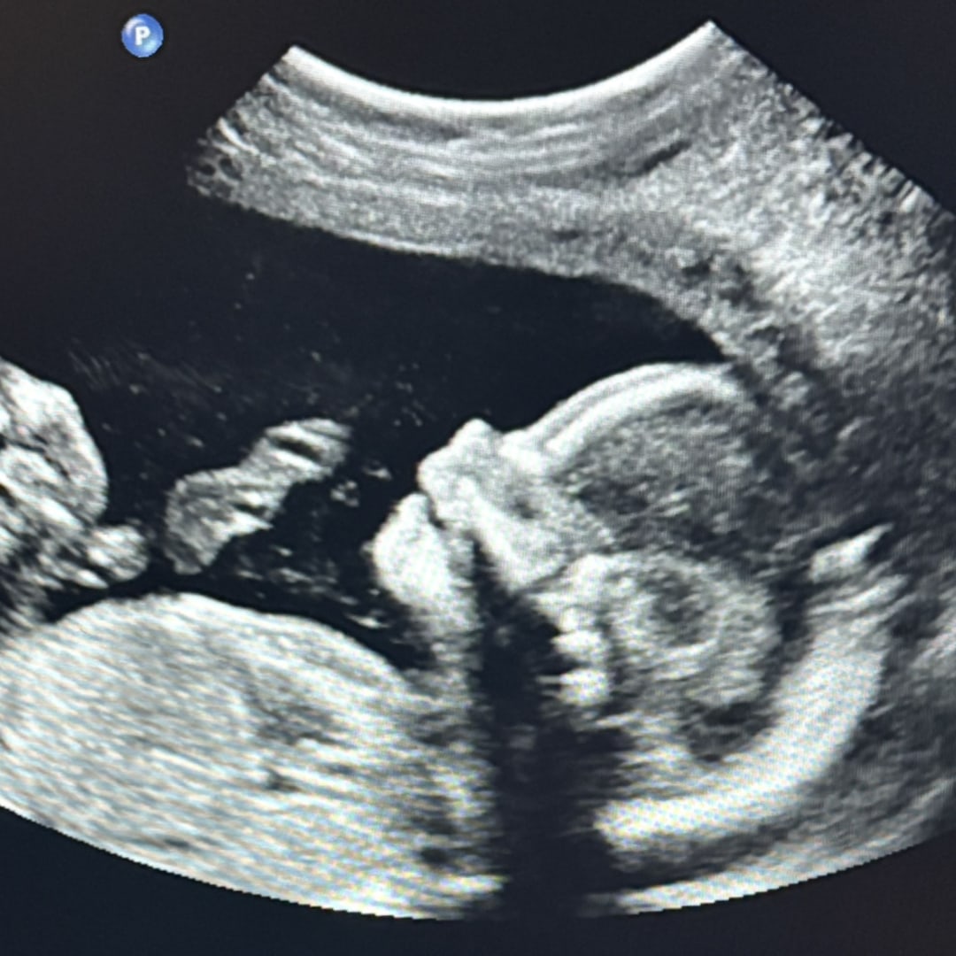 Photo shared by Rachel for their Babylist baby registry.